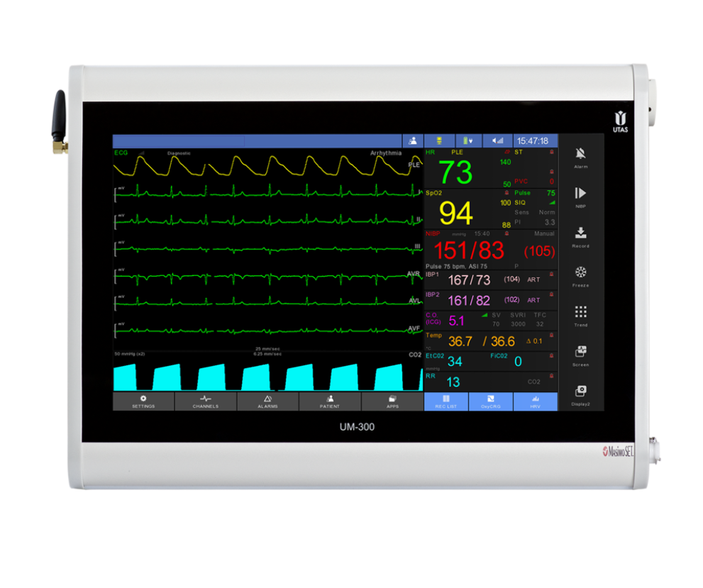 ets medical patient monitoring system